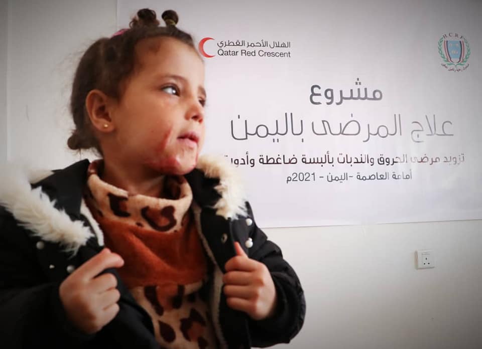 صندوق رعاية المعاقين والهلال الأحمر القطري يدشنان مشروع دعم مرضى الحروق والندبات بالالبسة الضاغطة والادوية ..